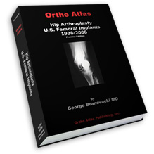 Hip Arthroplasty - U.S. Femoral Implants 1938-2008