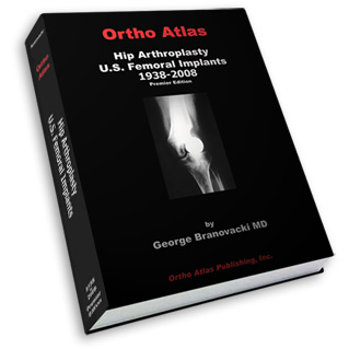 Hip Arthroplasty<br />U.S. Femoral Implants 1938-2008